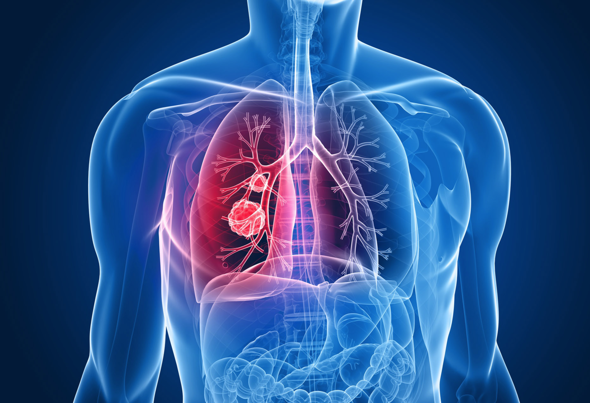 La OMS alerta del aumento de infecciones respiratorias agudas 